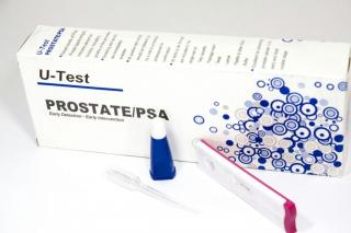 Prostate-Specific Antigen Test